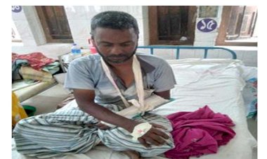 পোরশায় অটোভ্যান চালকের হাত ভেঙ্গে দিলেন যাত্রী