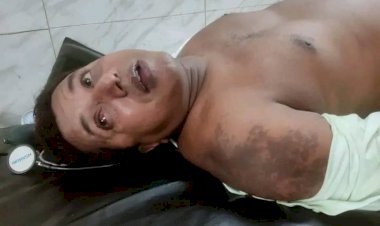 নরসিংদীর মনোহরদীতে শিক্ষককে ছুরিকাঘাত ও মারধর,চোখে জখম