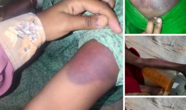 রাজশাহীর মোহনপুরে জমি বিরোধে হামলা-ভাঙচুর, নারীদের শ্লীলতাহানির অভিযোগ