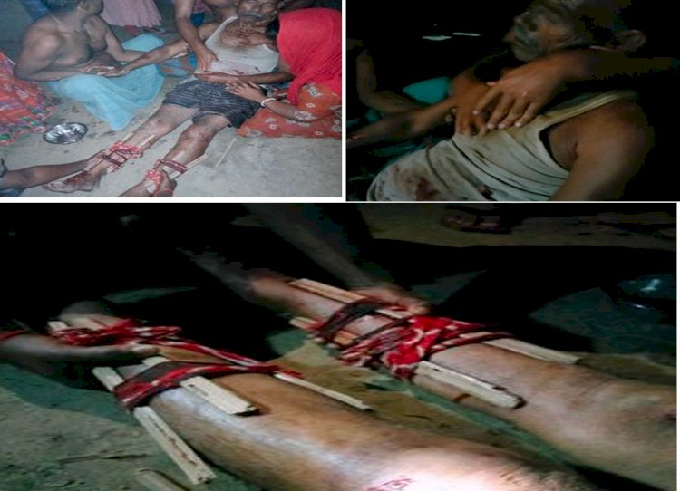কালুখালীর লাড়িবাড়ীতে সংখ্যালঘুর হাত-পা ভেঙ্গে দিয়ে বাড়ীতে হামলা ও লুটপাটের অভিযোগ