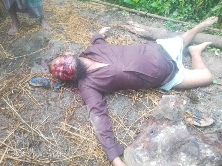 নাইক্ষ্যংছড়ি থানার পার্শ্ববর্তী বৈদ্যুতিক শর্ট সার্কিট দিয়ে হত্যার অভিযোগ!