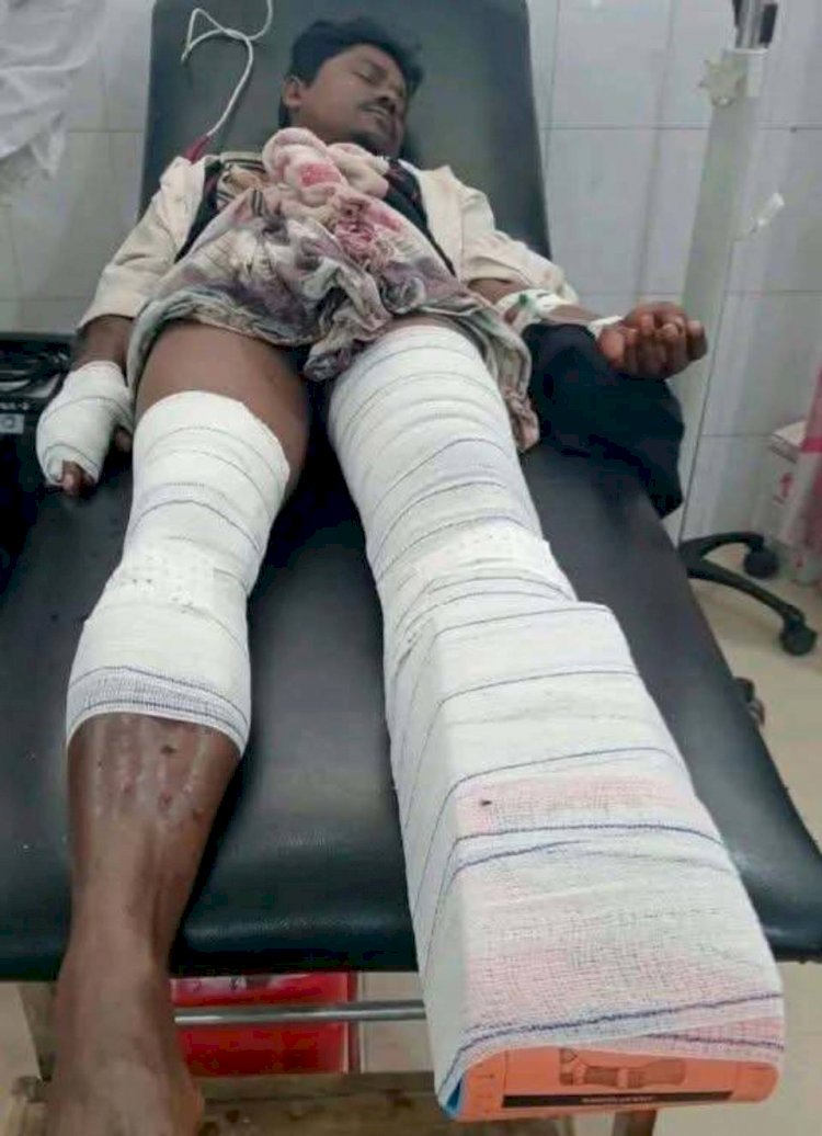 নাইক্ষ্যংছড়ি সীমান্তে মাইন বিস্ফোরণে আহত দুই!