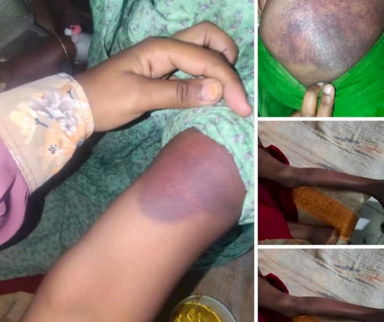 রাজশাহীর মোহনপুরে জমি বিরোধে হামলা-ভাঙচুর, নারীদের শ্লীলতাহানির অভিযোগ