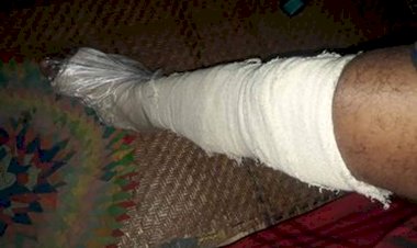 নওগাঁ জর্জ কোর্টের নোটিশ জারিকারক আবু সাঈদের উপর  সন্ত্রাসী হামলা