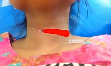 চিরিরবন্দরে  নেশাগ্রস্থ  স্বামী নিজ স্ত্রীরর গলা কেটে  হত্যার চেষ্টা!