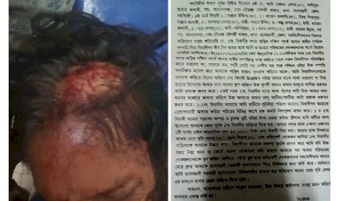 মনোহরদীতে  জমি সংক্রান্ত বিরোধের জেরে গুরুতর আহত -১