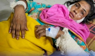 নওগাঁর বদলগাছীর বৈকুন্ঠপুরে শাবনাজ আক্তার নামে এক  নারীকে কুপিয়ে জখম