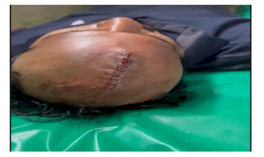হোমনায় তুচ্ছ ঘটনা কে কেন্দ্র করে একজন কে মারধরের অভিযোগ