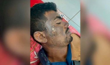 চাঁদা দাবিকে কেন্দ্র করে এসিড নিক্ষেপ