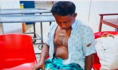 কৃষকের পা ভেঙ্গে দিলো হাতুরি দিয়ে