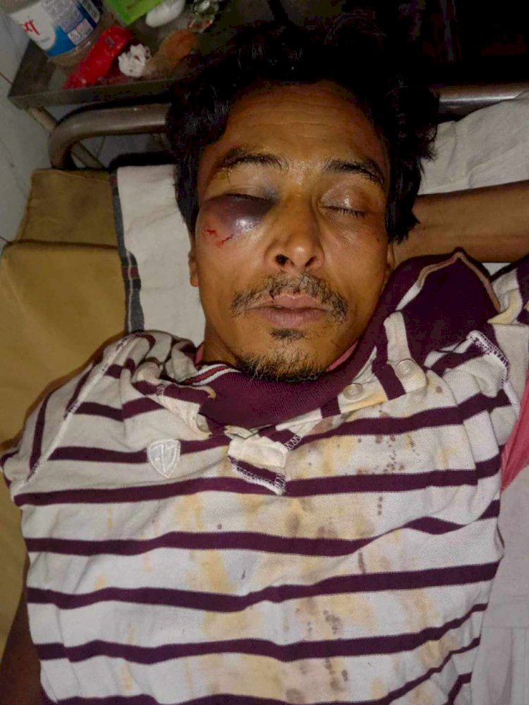 নরসিংদীর শিবপুরে জোর পূর্বক জমিতে বাউন্ডারি ওয়াল নির্মাণ করতে বাধা দেয়ায় হামলা করে দুইজনকে গুরুতর জখম করার অভিযোগ পাওয়া গেছে