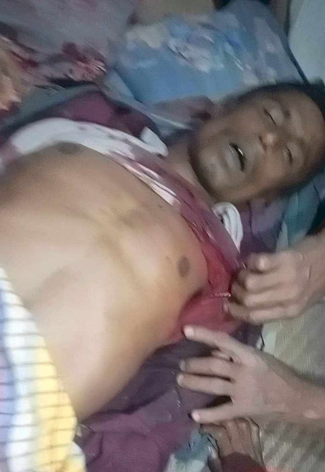 রামুতে গরু চোরাচালান নিয়ে ফের গোলাগুলি, নিহত ১