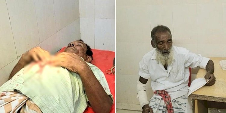 পাবনার আটঘরিয়ায় দুই চেয়ারম্যান প্রার্থীর সমর্থকদের পাল্টাপাল্টি হামলার অভিযোগ, আহত ১০