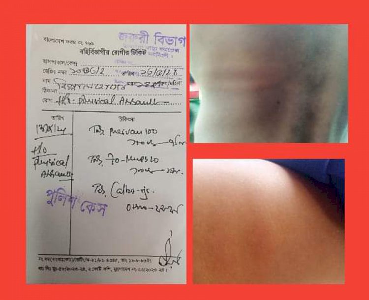 শিবপুরে ৫ম শ্রেণির ছাত্র কে পিটিয়ে আহত