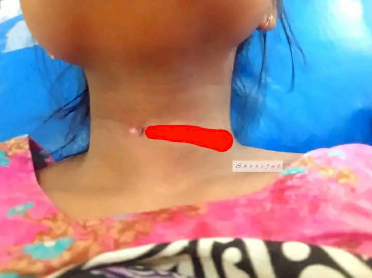 চিরিরবন্দরে  নেশাগ্রস্থ  স্বামী নিজ স্ত্রীরর গলা কেটে  হত্যার চেষ্টা!