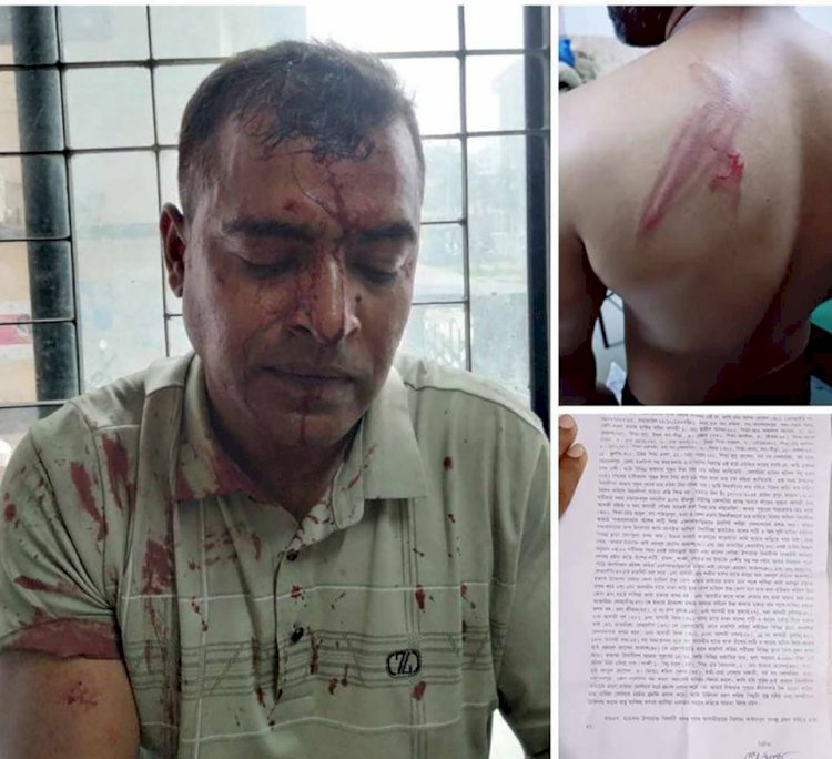 নওগাঁয় পুকুরে মাছ চুরি করতে বাধা দেওয়াই পুকুর মালিক সহ ৩ জন'কে কুপিয়ে জখম