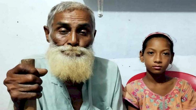 নওগাঁয় ৯৭ বছরের অন্ধ হারেজ উদ্দিন নাতির ঘাড়েভর দিয়ে রাস্তায় রাস্তায় ঘুরে বেড়াচ্ছেন দেখার কেউ নেই