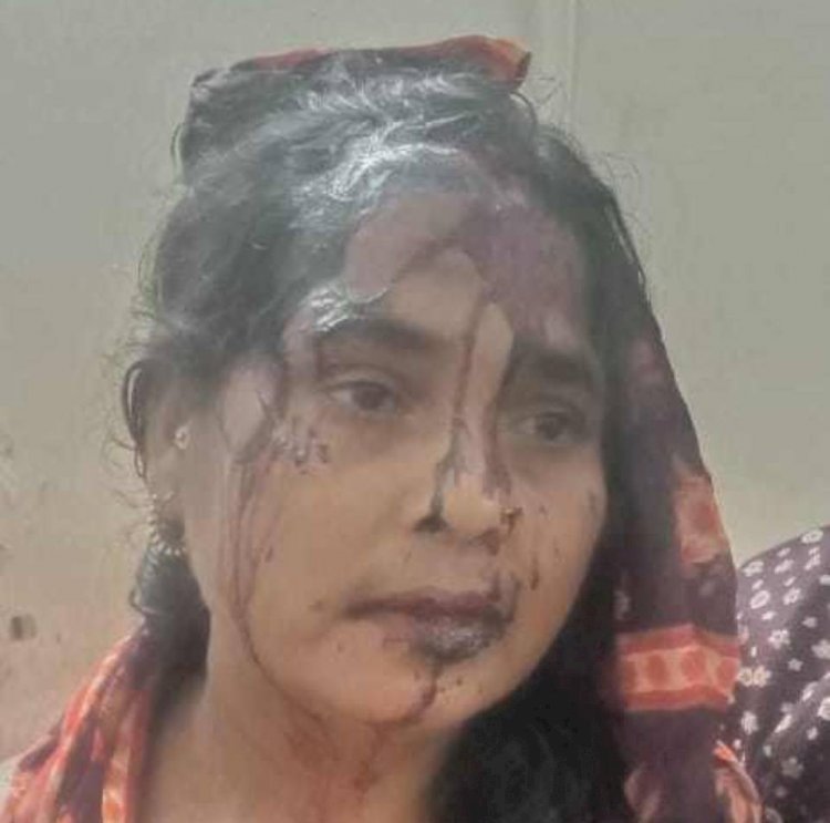 গলাচিপায় তুচ্ছ ঘটনাকে কেন্দ্র করে  ২ জনকে কুপিয়ে জখম, হাসপাতালে ভর্তি