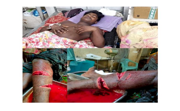 আইসিইউতে জীবনমৃত্যুর সন্ধিক্ষণে শেরপুর জেলা ছাত্রলীগের সদস্য শাকিল।