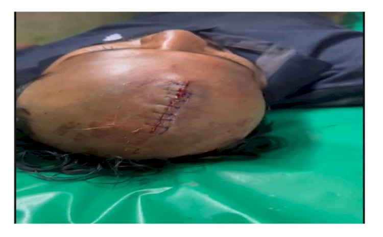 হোমনায় তুচ্ছ ঘটনা কে কেন্দ্র করে একজন কে মারধরের অভিযোগ