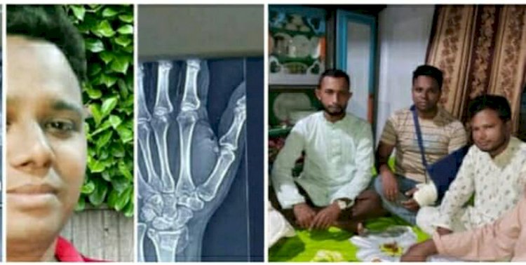 কেশবপুরে মোটরসাইকেল দুর্ঘটনায় সাংবাদিক আক্তার হোসেন আহত