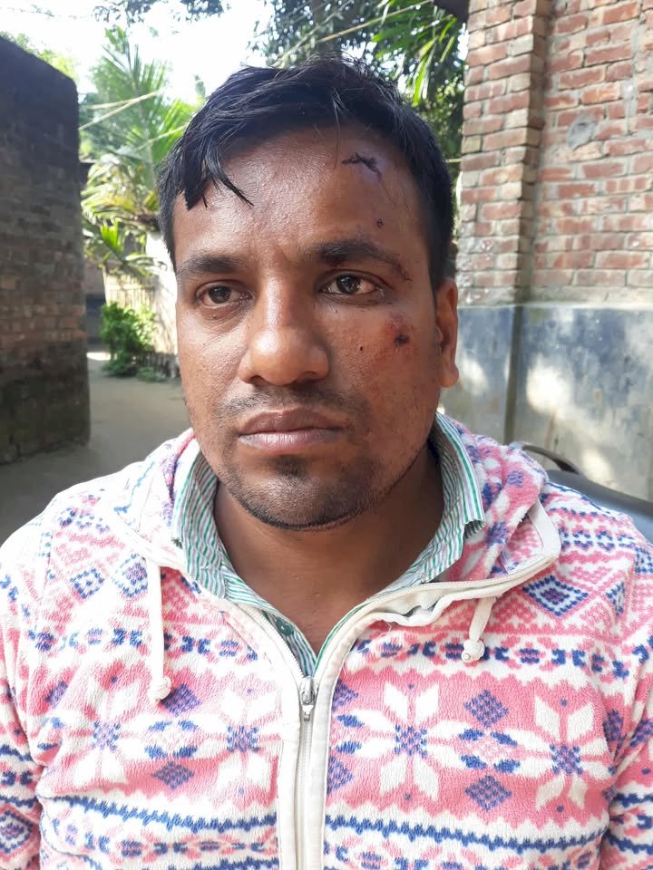 চিরিরবন্দর উপজেলা রাণীরবন্দরে বোরখা পড়ে অভিনব কৌশলে ছিনতাইয়ের চেষ্টা।