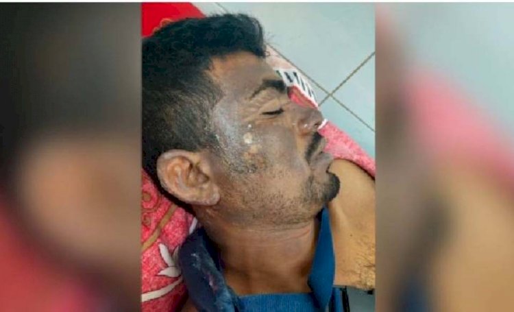 চাঁদা দাবিকে কেন্দ্র করে এসিড নিক্ষেপ