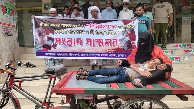 হোমনায় ৯ বছরের শিশুর উপর নৃশংস হামলা।। মানুষের দ্বারে দ্বারে ঘুরেও বিচার পায়নি অসহায় বাবা-মা