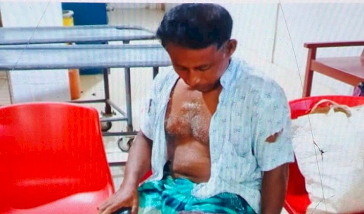 কৃষকের পা ভেঙ্গে দিলো হাতুরি দিয়ে