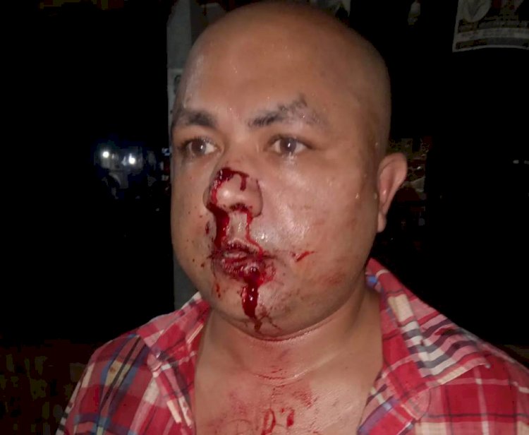 শ্রীপুরে বিএনপির কর্মীর উপর হামলা, প্রাথমিক সত্যতা পেল পুলিশ